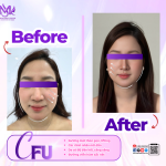 CFU – GIẢI PHÁP VÀNG CHO LÀN DA KHÔNG TUỔI Bf At CFU (2)